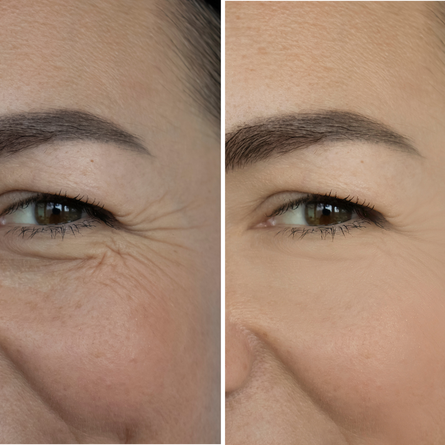 Smoothness and freshness around the eyes